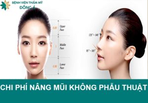 Chi phí nâng mũi không phẫu thuật hết bao nhiêu tiền?