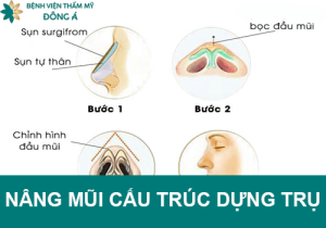 Nâng mũi cấu trúc dựng trụ thế nào? Ai nên thực hiện sửa mũi