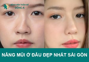 Review nên nâng mũi ở đâu đẹp nhất Sài Gòn