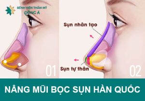 Nâng mũi bọc sụn Hàn Quốc – Đẹp như sao Hàn