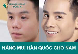 Nâng mũi Hàn Quốc cho nam giới có gì đặc biệt?