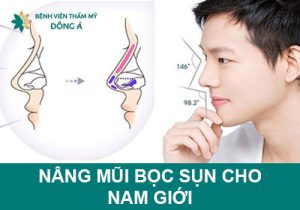 Nâng mũi bọc sụn cho nam giới đẹp chuẩn “soái ca”