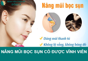 Nâng mũi bọc sụn có được vĩnh viễn không? Nhân tố nào tác động?