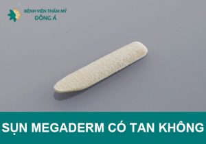 Sụn megaderm có tan không? Tổng hợp những lưu ý nên biết