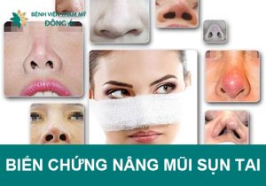 Những biến chứng nâng mũi sụn tai thường gặp