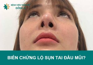 Biến chứng lộ sụn tai đầu mũi: Nguyên nhân và cách khắc phục hiệu quả!