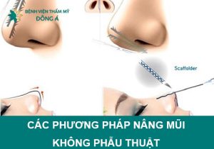 Các phương pháp nâng mũi không phẫu thuật