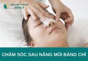 Hướng dẫn chăm sóc sau nâng mũi bằng chỉ chuẩn y khoa