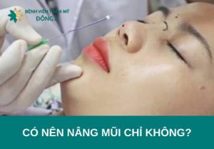 Có nên nâng mũi bằng chỉ không? 