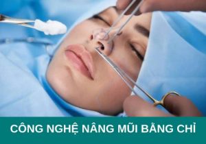 Công nghệ nâng mũi bằng chỉ có tốt không? Duy trì được bao lâu?