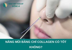 Nâng mũi bằng chỉ collagen có tốt không? Ý kiến của chuyên gia