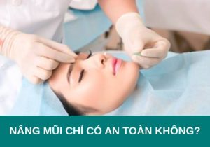 Phương pháp nâng mũi chỉ có an toàn không? Ý kiến chuyên gia