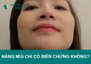 Nâng mũi chỉ có biến chứng không? Có nguy hiểm không?