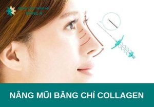 Nâng mũi chỉ collagen là gì? Có nên nâng mũi chỉ Collagen không?