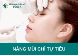 Nâng mũi chỉ tự tiêu là gì? Có an toàn và hiệu quả không? 