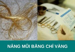 Nâng mũi bằng chỉ vàng 24k có tốt không? Chi phí bao nhiêu?