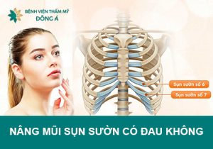 Nâng mũi sụn sườn có đau không? Có an toàn không