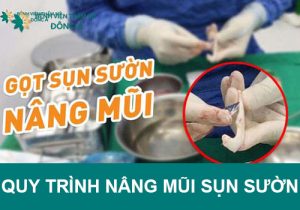 Quy trình nâng mũi sụn sườn được diễn ra như thế nào