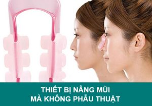 Thiết bị nâng mũi mà không cần phẫu thuật an toàn không?