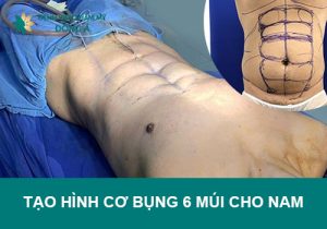 Tạo hình cơ bụng 6 múi cho nam không cần tập gym vất vả