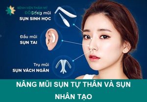 Nâng mũi sụn tự thân và sụn nhân tạo loại nào tốt hơn?