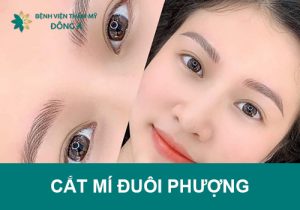 Cắt mí đuôi phượng phương pháp thay đổi cả tướng số, vận mệnh