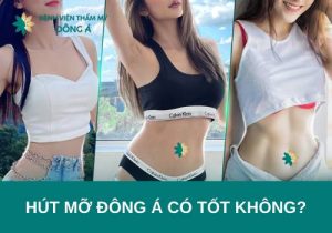 Hút mỡ Đông Á có tốt không? Quy trình hút mỡ chuẩn y khoa