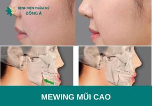 Tập mewing có giúp mũi cao không? Cách tập mewing mũi cao