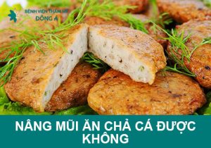 Nâng mũi ăn chả cá được không? Ngoài ra thì cần kiêng gì?