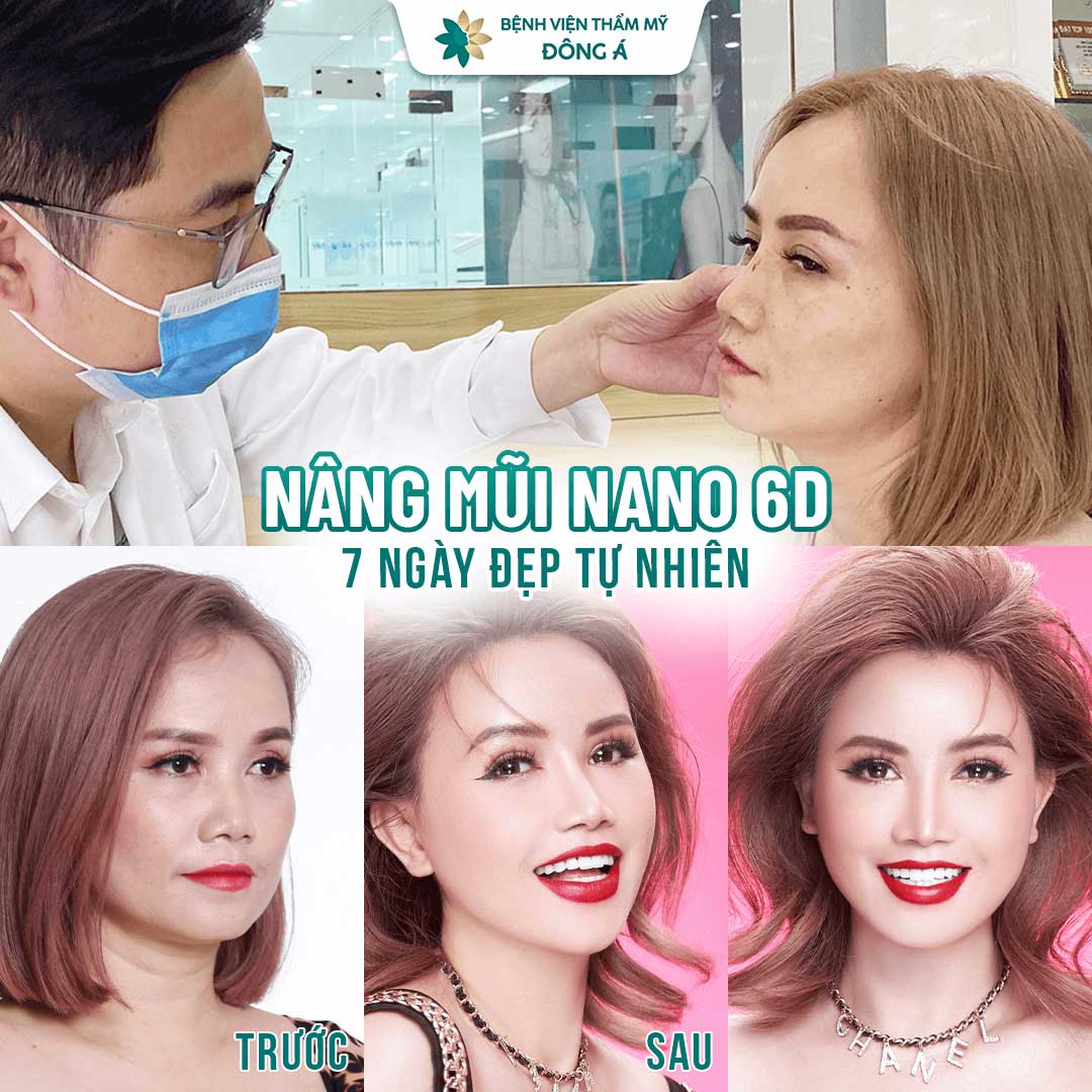 Hình ảnh diễn viên Hoàng Yến trước và sau nâng mũi tại Đông Á