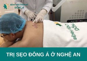 Dịch vụ trị sẹo Đông Á ở Nghệ An cam kết hiệu quả lên đến 98%