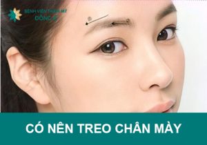 Có nên treo chân mày không? Giải đáp từ các chuyên gia