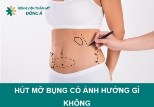 Hút mỡ bụng có ảnh hưởng gì không: Giải đáp của chuyên gia thẩm mỹ!