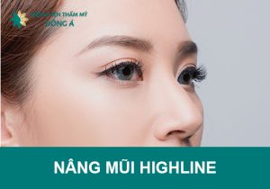 Nâng mũi Highline – Tạm biệt dáng mũi tẹt, gồ ghề!