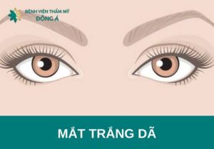  Phân tích tướng mắt trắng dã: Tính cách, vận mệnh, tình duyên