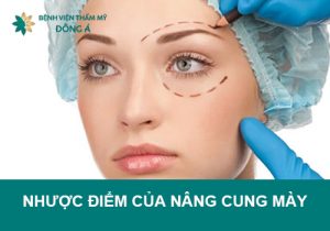 Nhược điểm của nâng cung mày bạn nên biết!