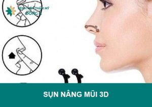 Tìm hiểu về sụn nâng mũi 3D là gì?Có tốt không?